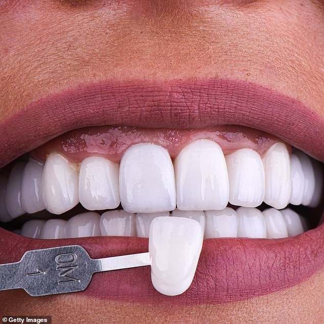 सैन्य दंतचिकित्सक सैनिकांना “तुर्की दात” वाहून जाण्यापासून चेतावणी देतात… कारण ते त्यांना सेवा करण्यापासून रोखू शकतात