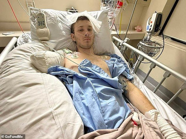 एका ऑस्ट्रेलियन किशोरवयीन मुलाने कामाच्या ठिकाणी झालेल्या भीषण अपघातात आपला हात गमावला – त्याचे प्रशिक्षण पूर्ण करण्याच्या काही आठवड्यांपूर्वी