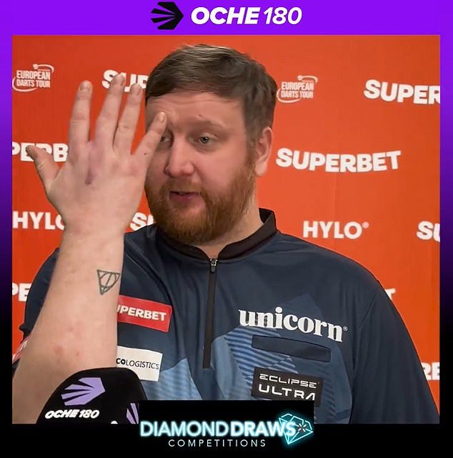 पराभवानंतर रागाच्या भरात टेबलावर ठोसा मारल्याने ॲली पॅली डार्ट्स स्टार जखमी