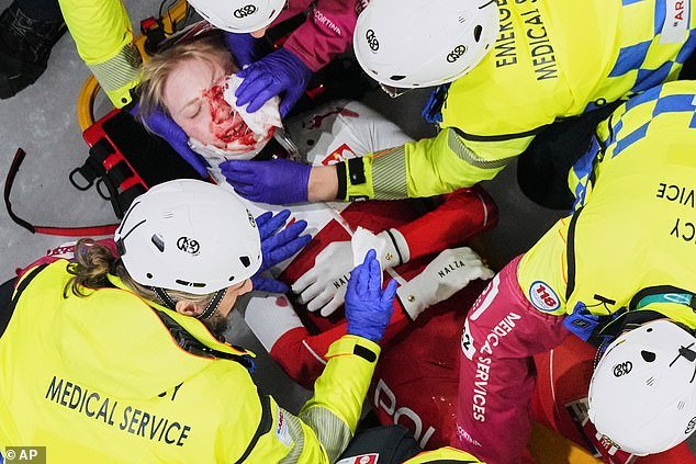 हिवाळी ऑलिम्पिक स्पीड स्केटर प्रतिस्पर्ध्याच्या स्केटने डोळा कापल्यामुळे रक्तरंजित गोंधळात निघून गेला