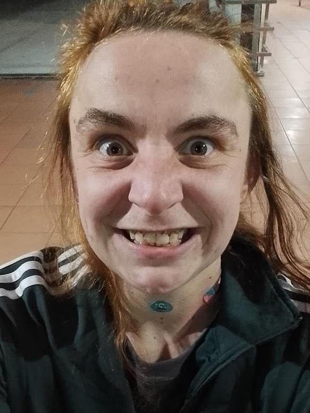 एका अनोळखी व्यक्तीला दिवसाढवळ्या भोसकल्याचा आरोप असलेला माणूस “मानसिक अपंगत्व” संरक्षण अंतर्गत स्वातंत्र्यासाठी आणखी एक बोली लावत आहे.