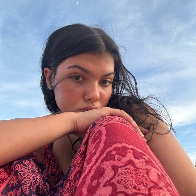 डिंगोने हल्ला केल्यानंतर कॅनेडियन पर्यटकाच्या मृत्यूचे खरे कारण