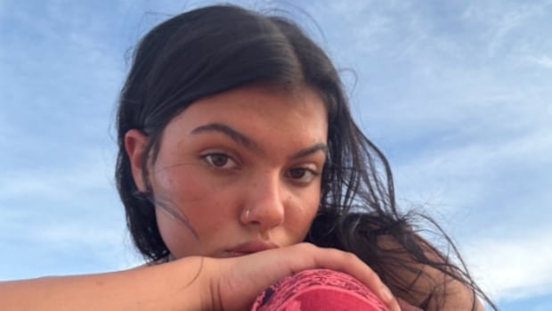 ऑस्ट्रेलियन बीचवर पाईपर जेम्सच्या शरीरावर प्रदक्षिणा घालणारे डिंगो