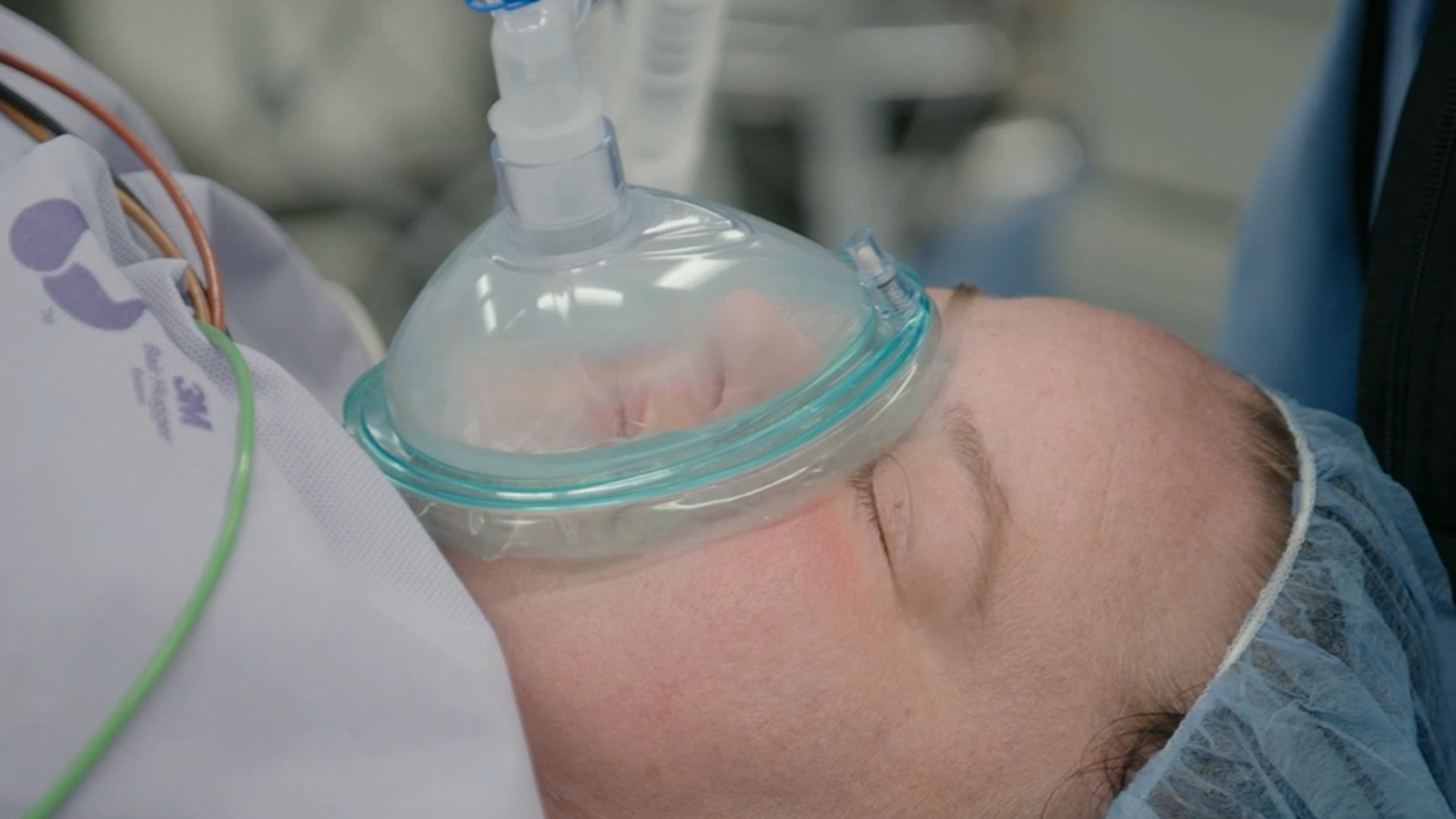 ‘1000-पाऊंड सिस्टर’ स्टार एमीने व्हिडिओमध्ये आळशी डोळा सुधारण्यासाठी शस्त्रक्रिया केली