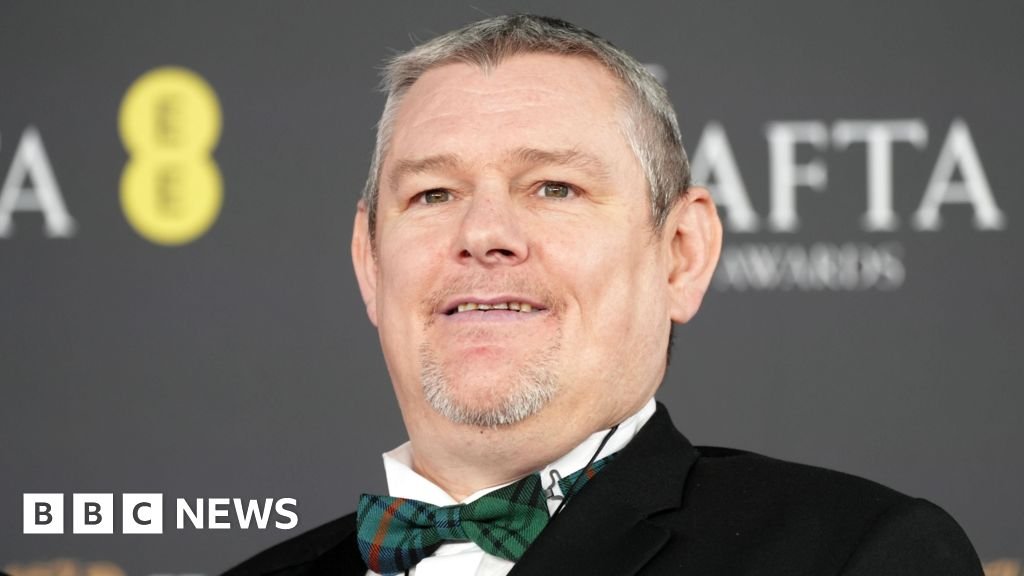 सॅटरडे नाईट लाइव्हने टॉरेटच्या स्केचवर ‘धक्कादायक’ टीका केली