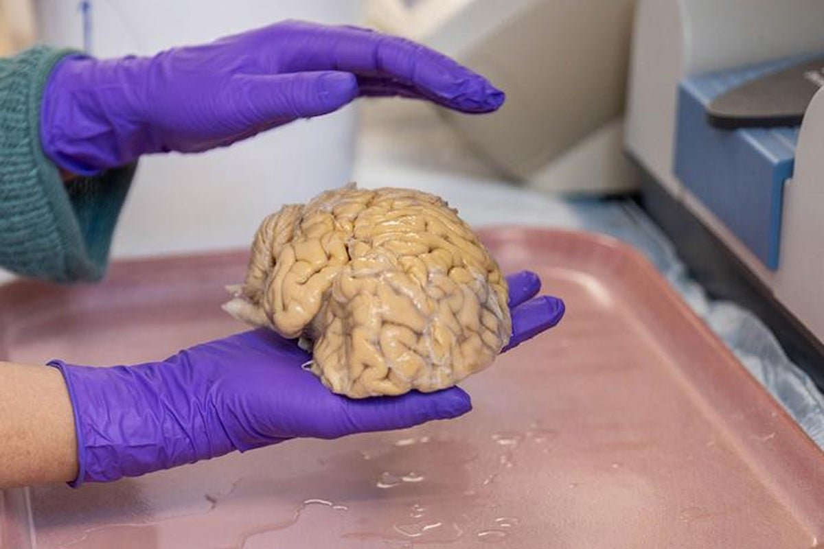 डिमेंशियासाठी ‘सुपर-एल्डर्स’ कशामुळे लवचिक बनतात याचे रहस्य शेवटी उघड होऊ शकते