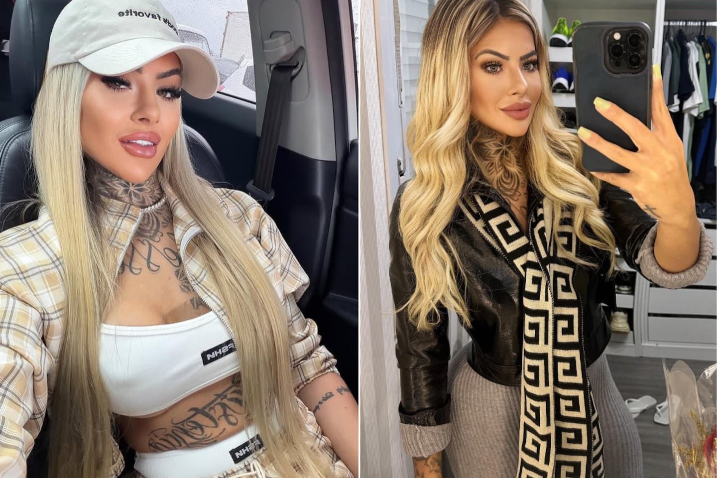 27 वर्षीय प्रभावशाली आणि दोन मुलींची आई प्लास्टिक सर्जरीनंतर 18 दिवसांनी मरण पावली