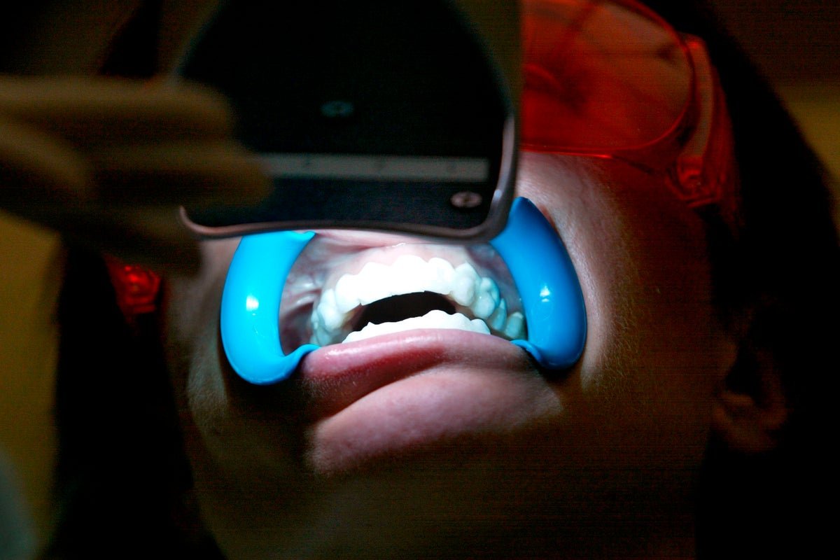 चिनी शास्त्रज्ञांनी एक पावडर विकसित केली आहे जी टूथब्रशच्या कंपनाने दात पांढरे करते आणि दुरुस्त करते.