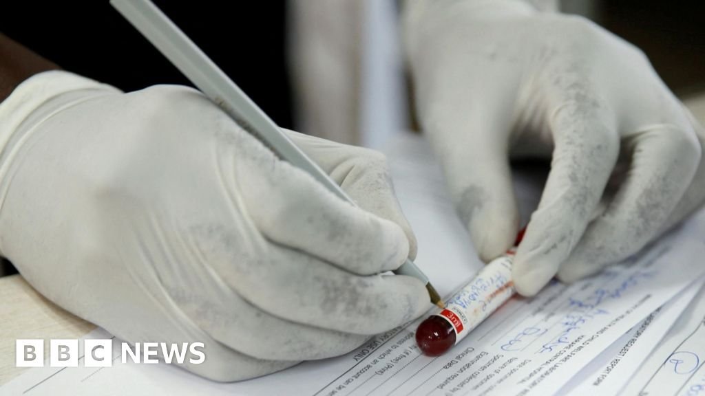 संवेदनशील डेटा चिंतेमुळे झिम्बाब्वेने यूएस आरोग्य करार नाकारला