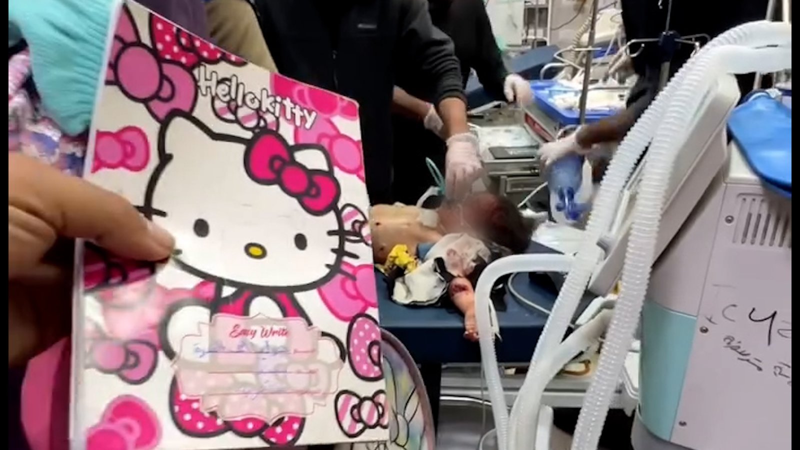 गाझा इस्रायल-पॅलेस्टाईन संघर्षात इस्रायली हवाई हल्ल्यात वडिलांचा मृत्यू झाल्यानंतर डॉक्टर मुलीला वाचवण्याचा प्रयत्न करत आहेत